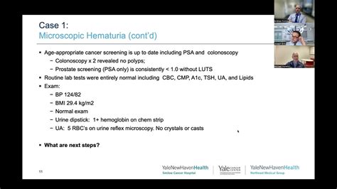 Smilow Shares With Primary Care Bladder Cancer Youtube