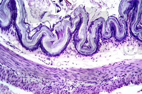 Rat Vagina Transverse Section 125x Rat Mammals Reproductive