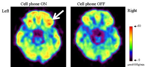 Study: Cell Phone Radiation Stirs Brain Activity, but Health Effects Unknown | PBS NewsHour