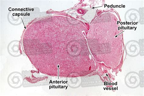 Man Pituitary Gland Transverse Section 7x Man Mammals