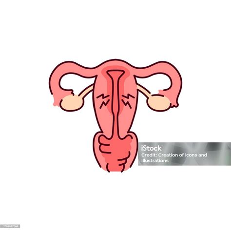 Endometrial Hyperplasia Color Line Icon Gynecology Problem Stock Illustration Download Image