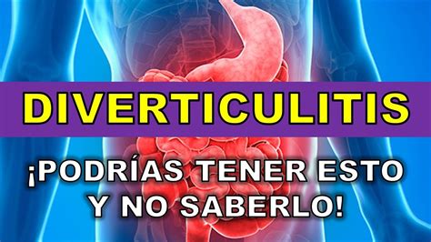 🔴 Diverticulitis Signos Y SÍntomas Complicaciones DiagnÓstico Y