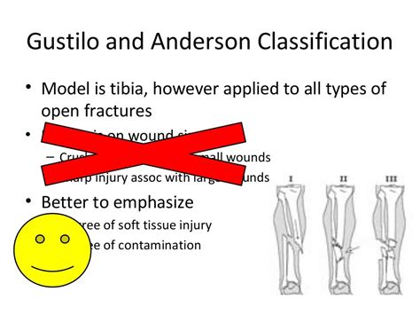 management of open fracture