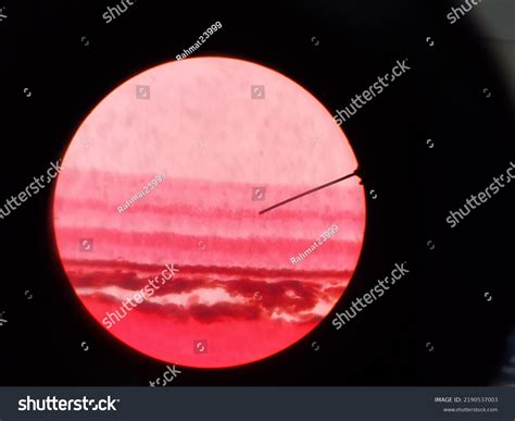 Histology Eye Ear Skin Using Microscope Stock Photo 2190537003 ...