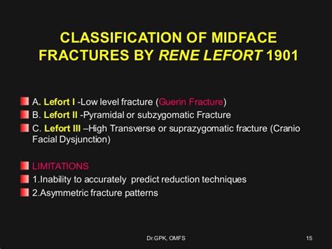 Le Fort Fractures