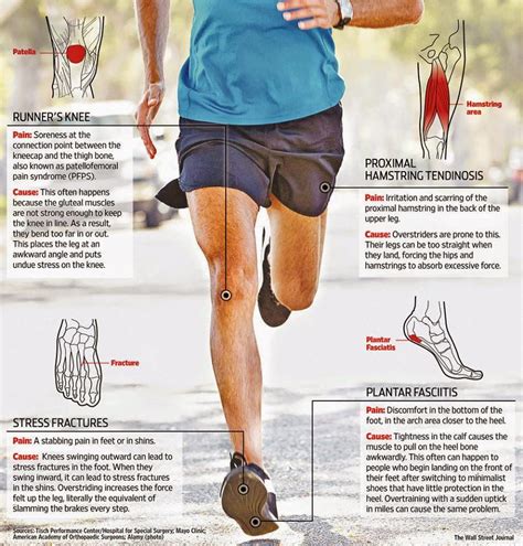 Accretive Health: Running-related injuries