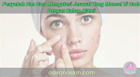 Penyebab Dan Cara Mengatasi Jerawat Yang Muncul Di Dada Dengan Bahan Alami Skincare Terbaik