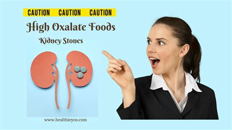 High Oxalate Foods – Beware! - Healthieyoo