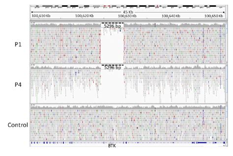 Identification Of Putative Large Deletion In Whole Genome Data In P1