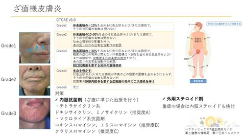 令和4年度 第1回 薬薬連携を充実させるための研修会 開催報告 国立がん研究センター 中央病院