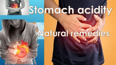 Stomach Acidity Treatment Without Medication YouTube