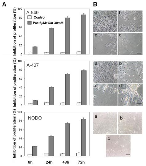 IJMS | Special Issue : Advances in Molecular Oncology (special issue)