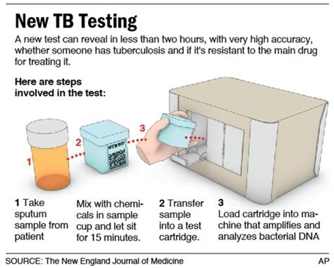 New Rapid Molecular Pathology Test For Tuberculosis Wins Favor With World Health Organization