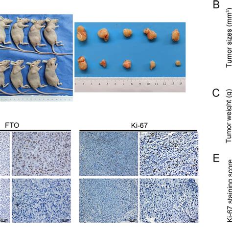 Silencing FTO Inhibited Pancreatic Tumor Growth In Nude Mouse Models A