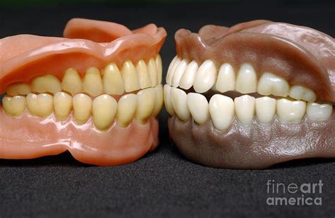 Two Sets Of Dentures Photograph by Medicimage - Fine Art America