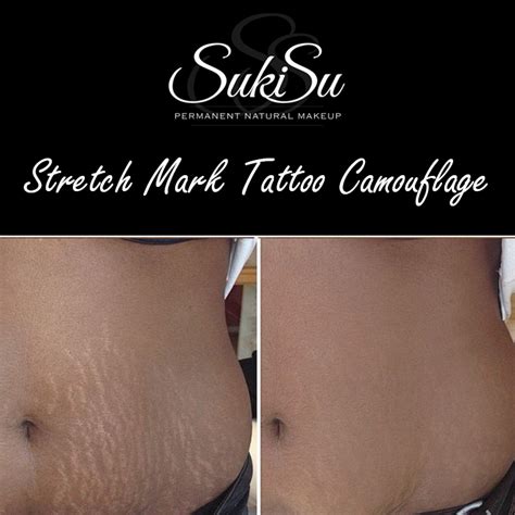 Makeup To Cover Stretch Marks