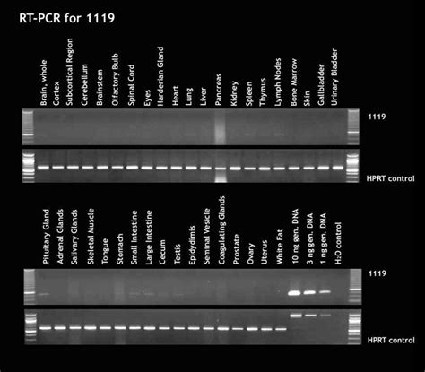 Scn11a Rt Pcr Gene Expression Assay Gxd