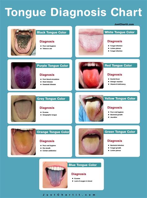 Tongue diagnosis chart - Chinese & Ayurveda Analyses