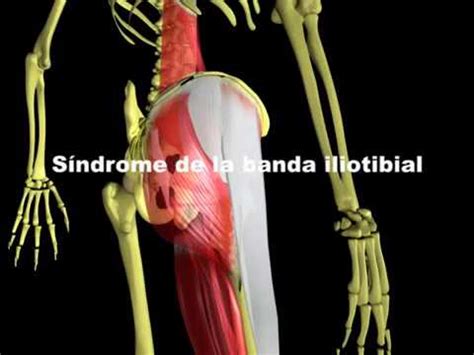 S Ndrome De La Banda Iliotibial Youtube