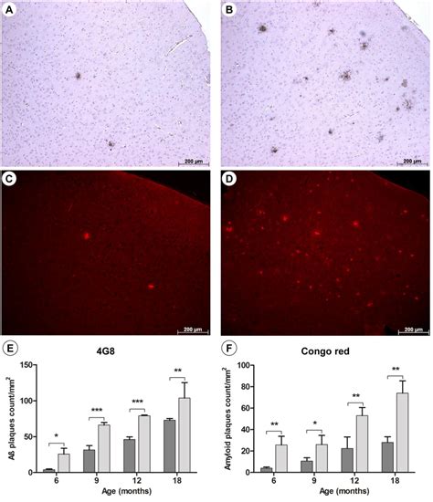 Amyloid Plaque Loads In Premotor Cortices M2 Representative Images