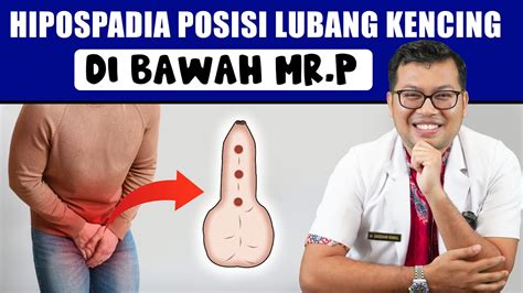 HIPOSPADIA KELAINAN BAWAAN LAHIR PADA LUBANG KENCING PRIA DOKTER