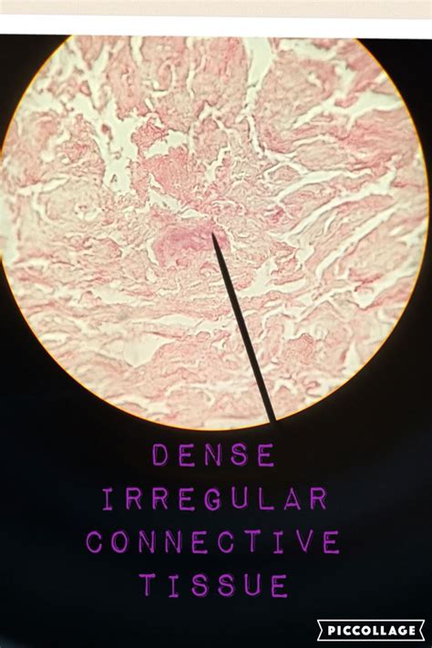 Dense Irregular Connective Tissue | Histology Slides