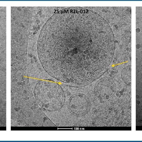 Representative cryo-TEM images; arrows show broken membranes and ...