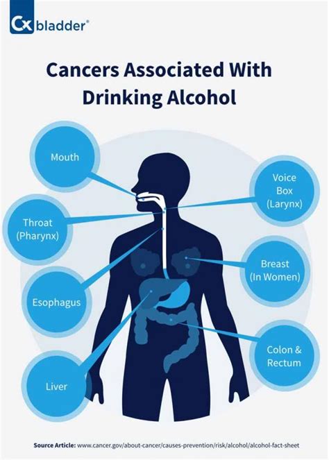 Alcohol And Cancer Cxbladder