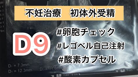 【不妊治療】d9レゴベル自己注射後の卵胞チェック酸素カプセルイノシトール Youtube