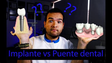 Implante Dental Vs Puente Dental Cual Es Mejor Dr Juan Tobar