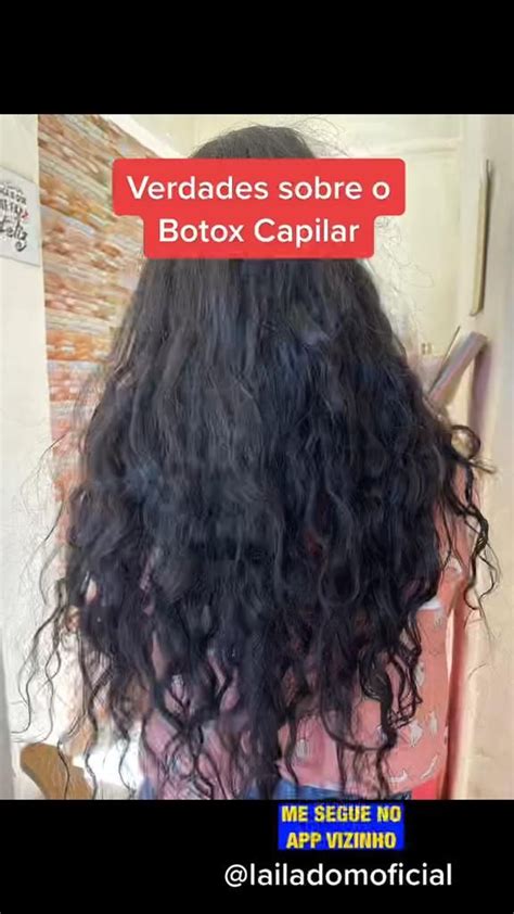 Quanto Tempo Dura O Botox No Cabelo Cacheado - Botox Capilar [Vídeo] | Botox no cabelo cacheado, Cabelo com botox ...