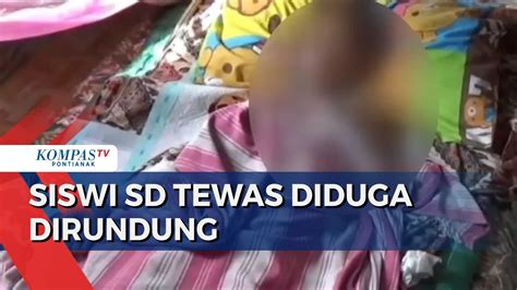 Empat Bulan Dirawat Akibat Luka Bakar Siswi SD Meninggal Diduga