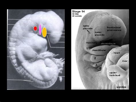 Pharyngeal Arches Primitive Pharynx Stomodeum Hind Brain Vesicle