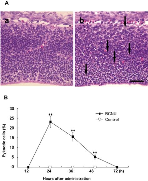 A. Histology of the telencephalic wall of a control fetus (a) and that... | Download Scientific ...