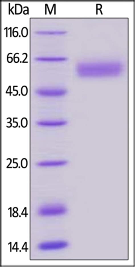 Acrobiosystems Acrobiosystems Biotinylated Human Btla Protein