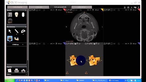 Tutorial Cs D Imaging Software Carestream Corte Personalizado Avi