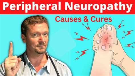 Peripheral Neuropathy Causes And Cures 2024 Bullish Health