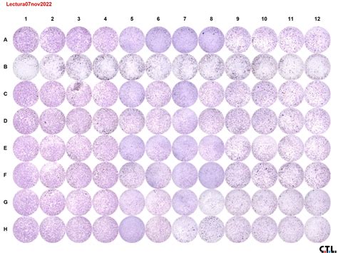 About Precipitate Membrane Staining And Negative Controls In Elispot Assay Elispot Mabtech