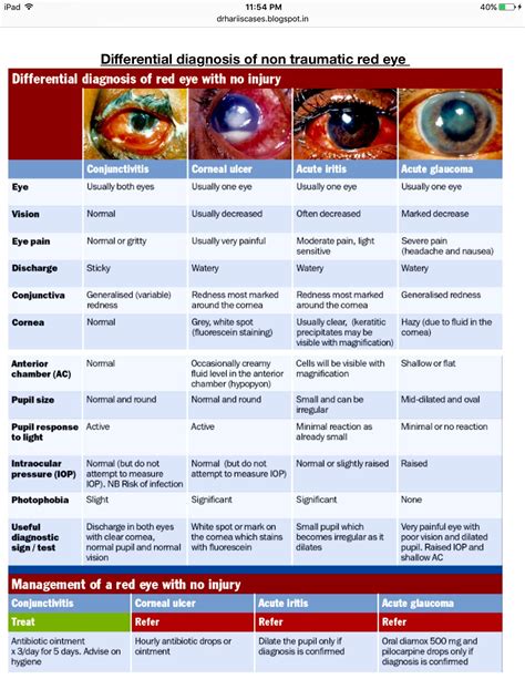 Allergic Conjunctivitis Symptoms Types Causes And Treatment Artofit