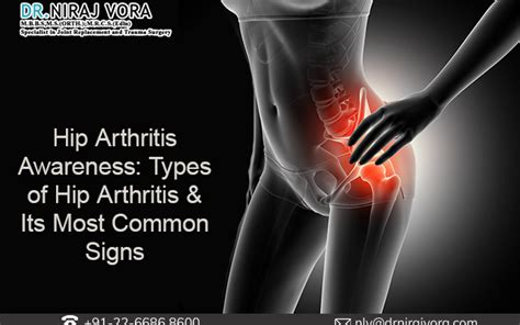 Hip Arthritis Awareness | Types of Hip Arthritis