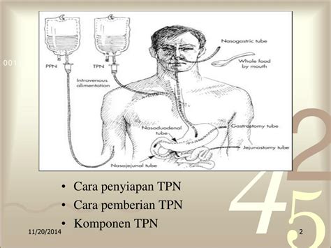 Ppt Total Parenteral Nutrition Tpn Powerpoint Presentation Free