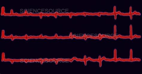 Photograph | Normal ECG | Science Source Images