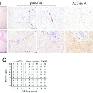 The Expression Of Activin A And Connective Tissue Growth Factor