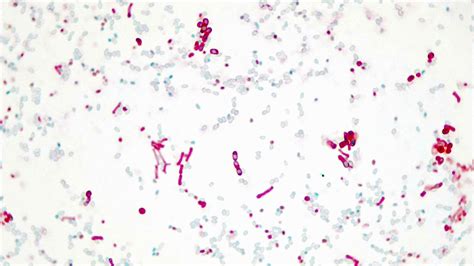 Micrograph Bacillus Megaterium D Endospore X P Oer Commons