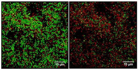 Confocal Laser Scanning Microscopy Images Of P Aeruginosa Biofilms