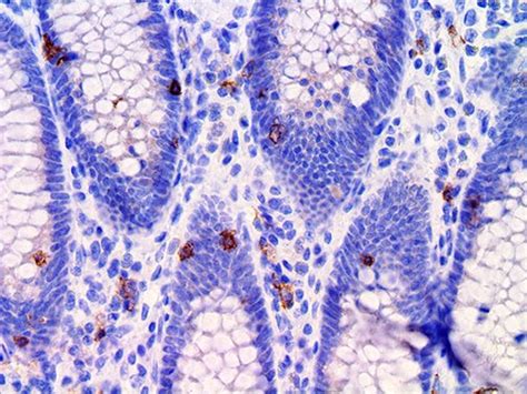 CD103 / ITGAE Antibody (EP206) - Bio SB