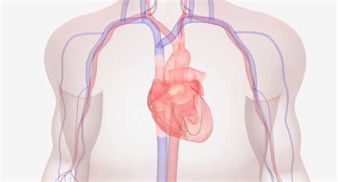 Premium Photo | The symptoms of hypertrophic cardiomyopathy