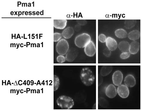 Localization Of Wild Type And Single Mutant Proteins Yeast Strains