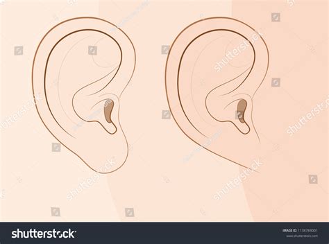 Unattached Earlobes