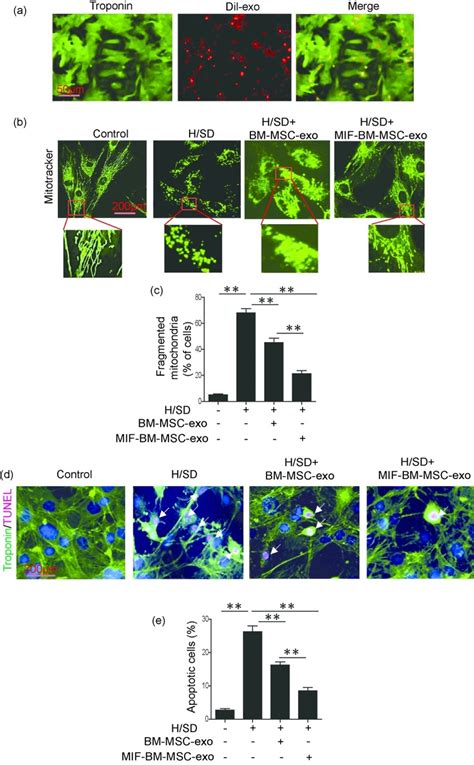 MSC Exo Ameliorates Cardiomyocyte Injury Induced By H SD Via Inhibition